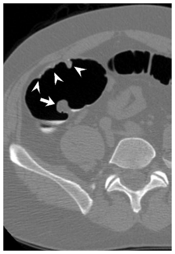 FIGURE 17