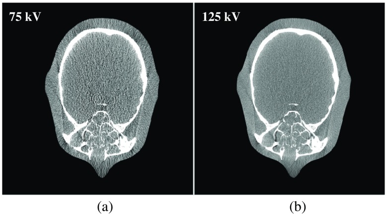 Fig. 9