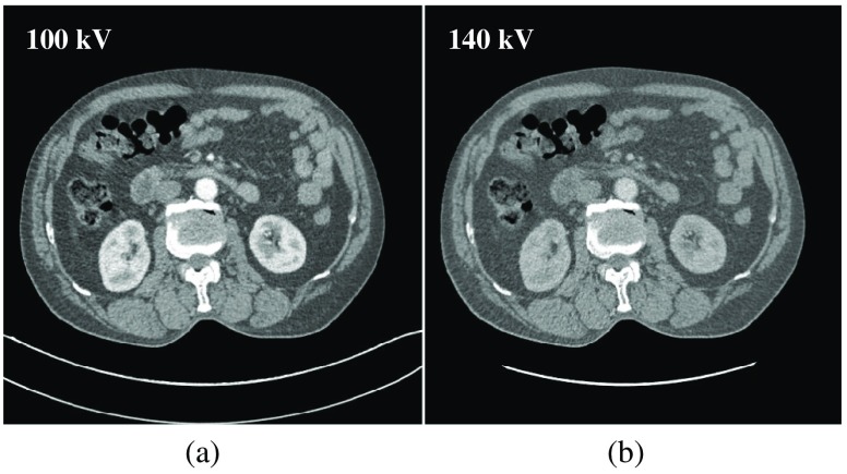 Fig. 13