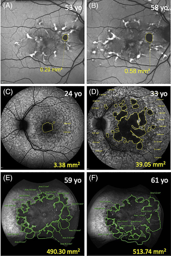 FIGURE 9