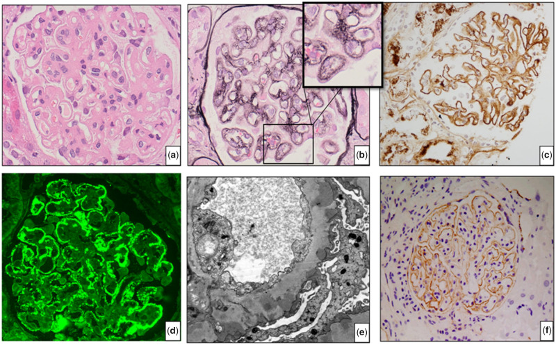 FIGURE 1