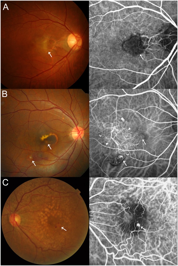 Fig 1