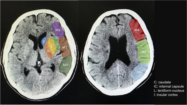 Fig. 2