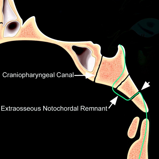 Fig 6.