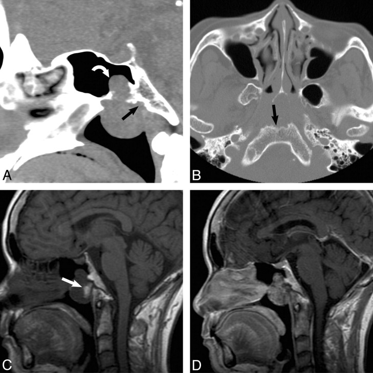 Fig 1.