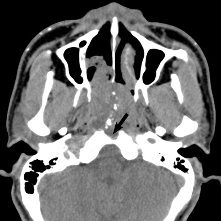 Fig 2.