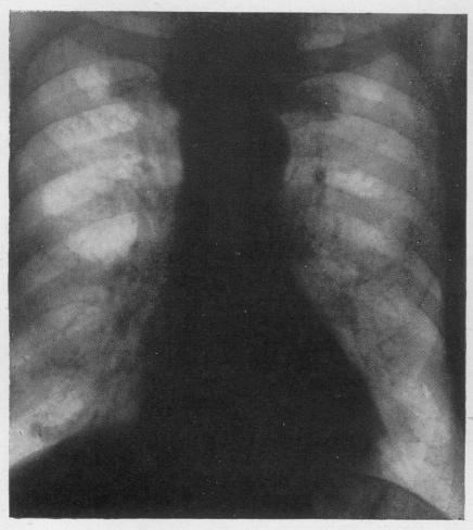 graphic file with name brjindmed00245-0050-a.jpg