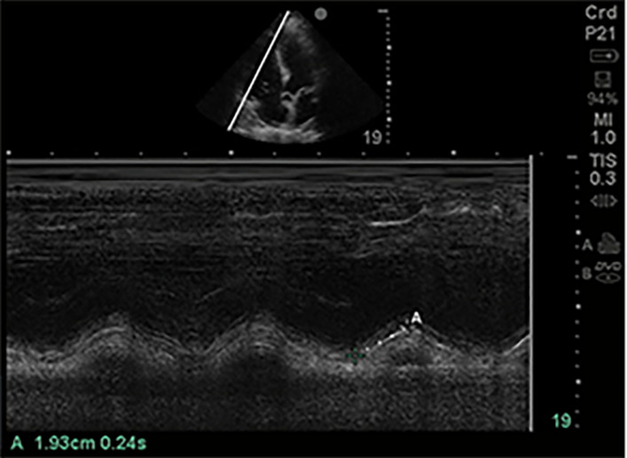 Figure 9