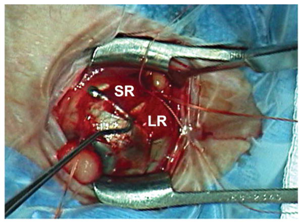 FIG. 4