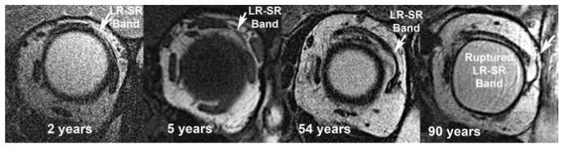 FIG. 3