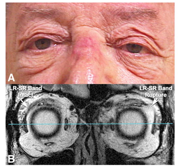 FIG. 7