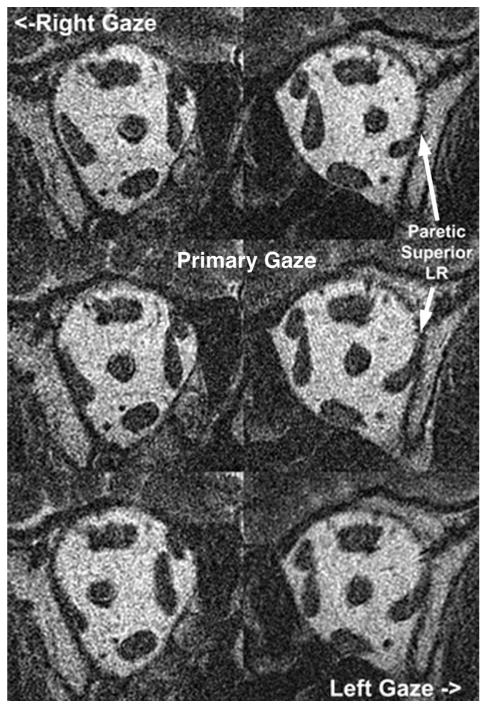 FIG. 8