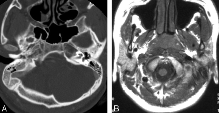 Fig 3.