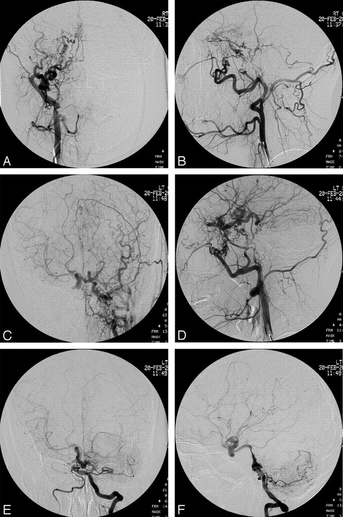 Fig 2.