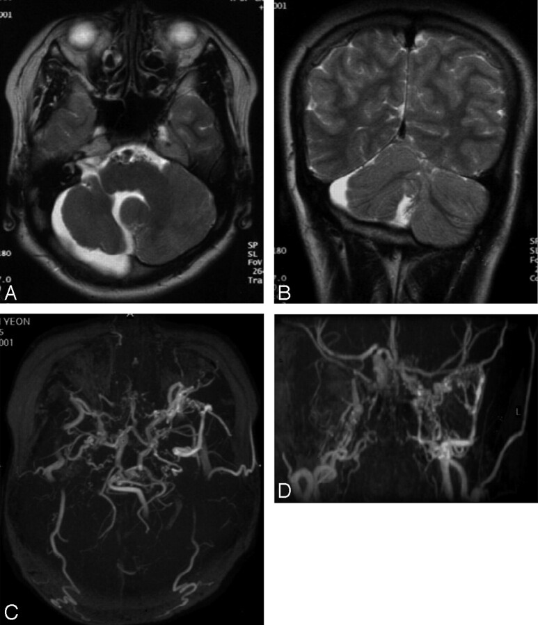 Fig 1.