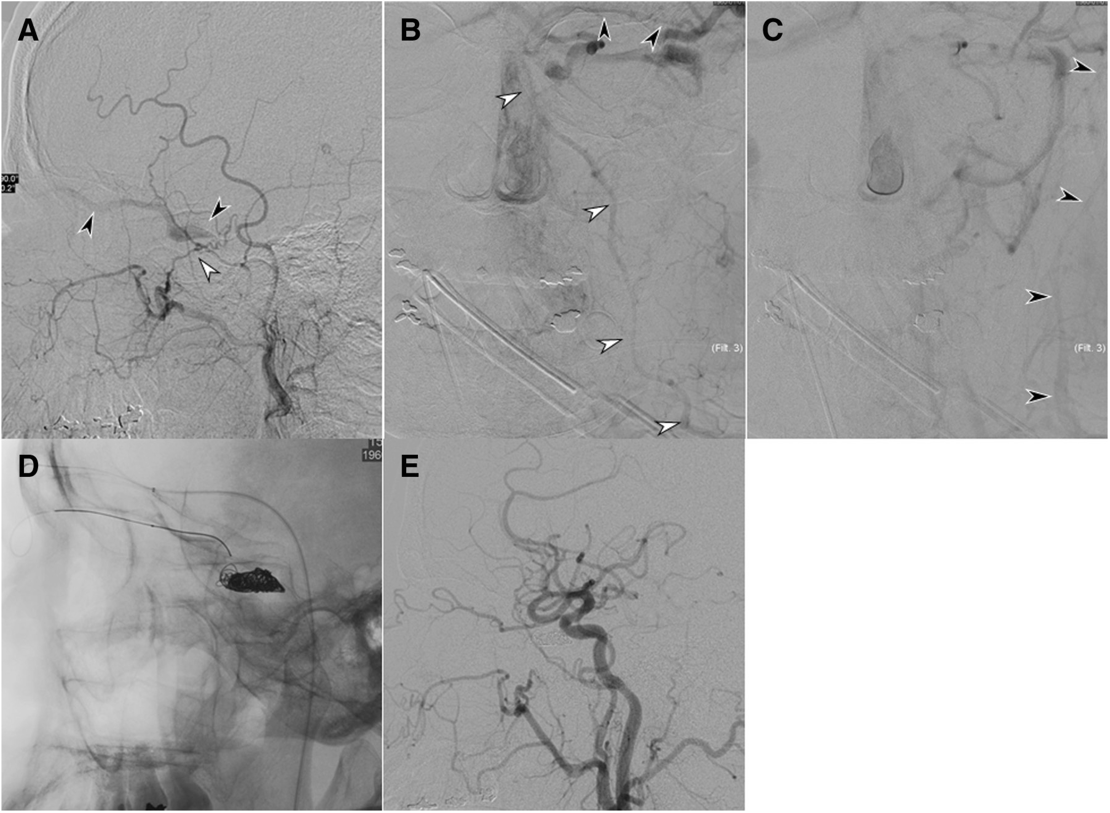 Fig. 13