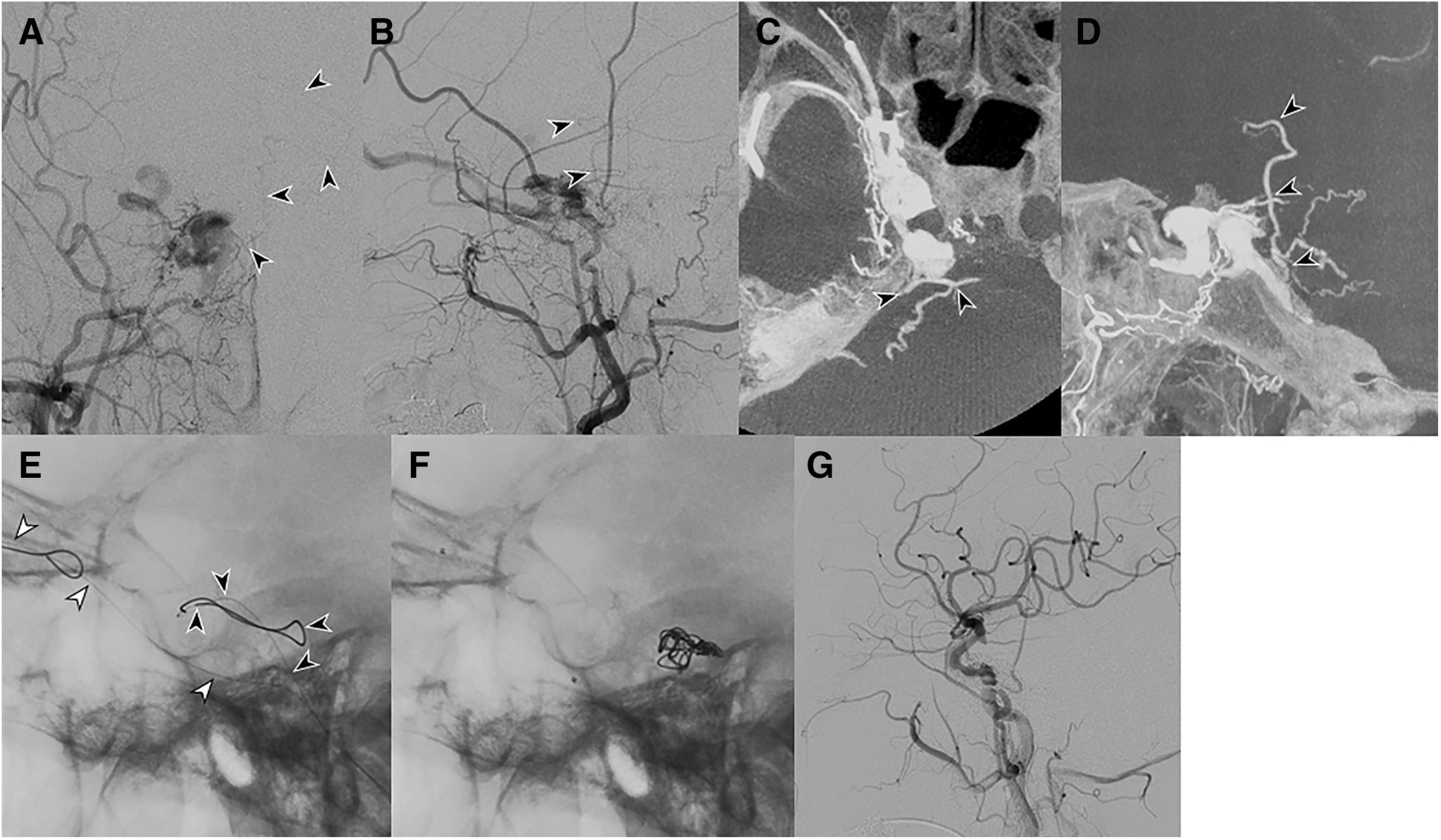 Fig. 12