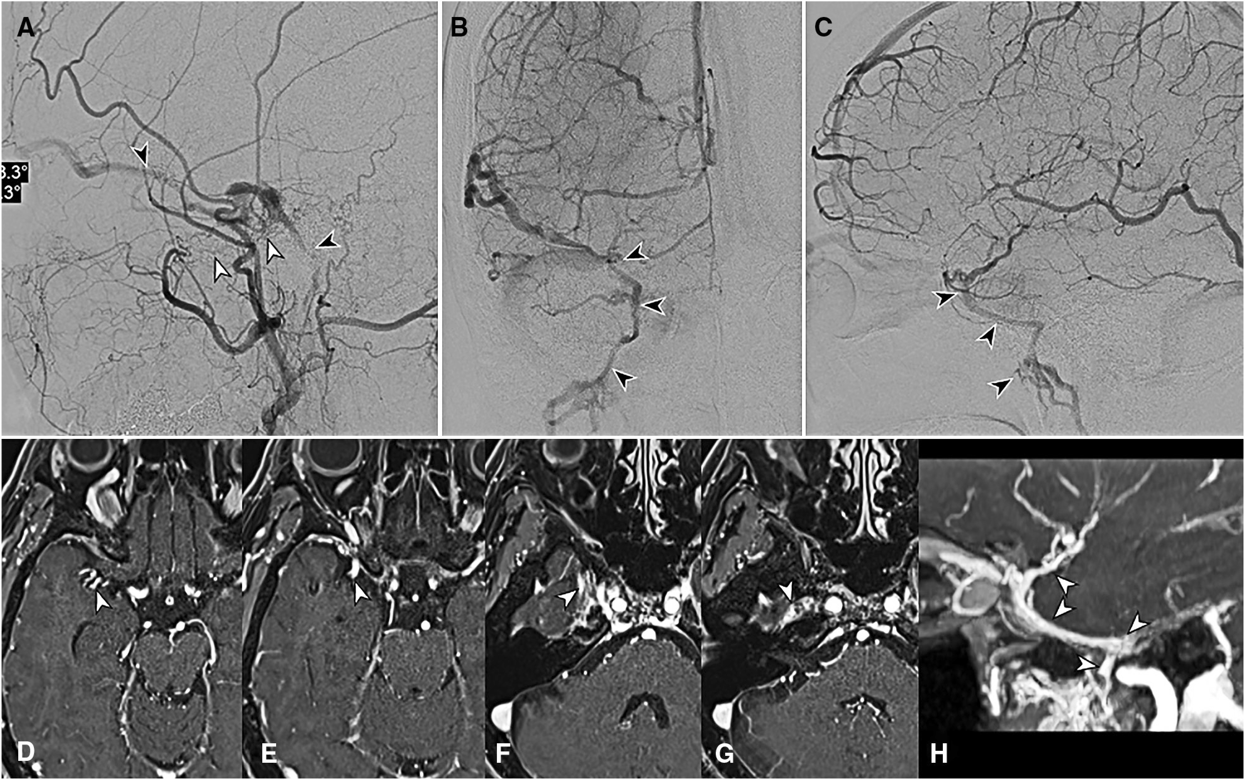 Fig. 10