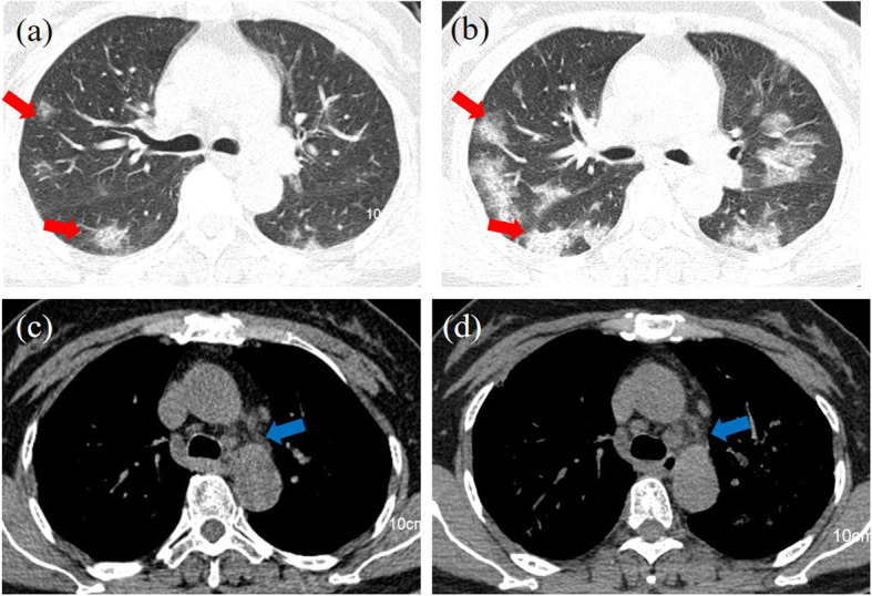 Fig. 4