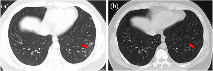 Fig. 5