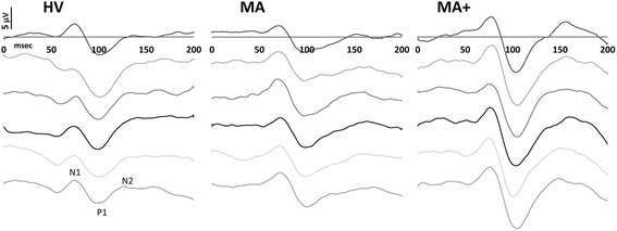 Fig. 1