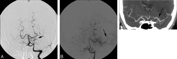 Fig 2.