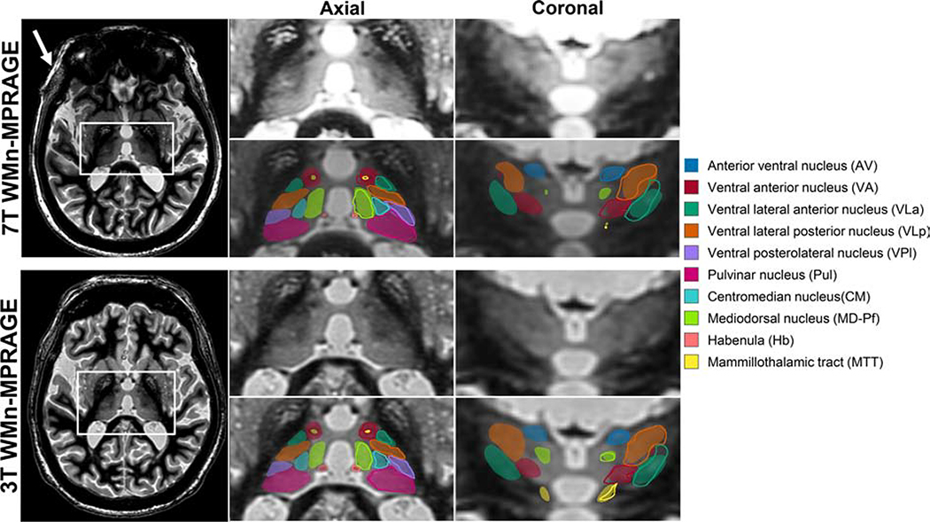 Figure 4: