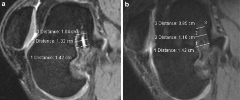 Fig. 5