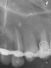 Fig.1I