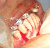 Fig. 2F