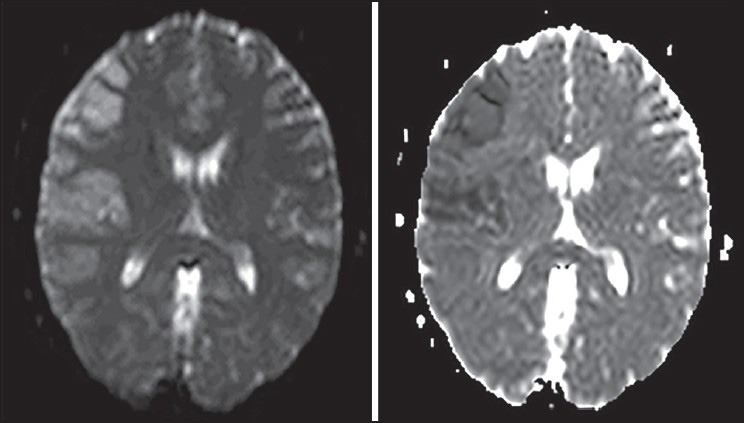 Figures 2 and 3