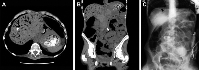 Fig. 1