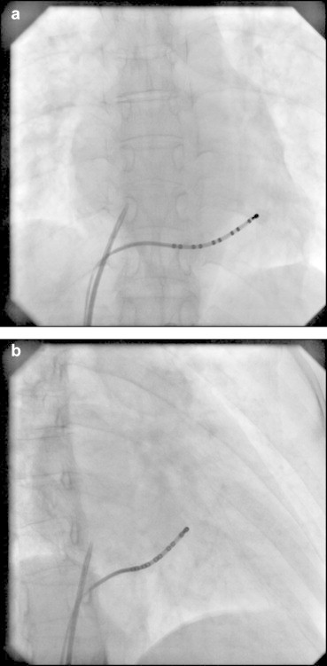 Fig. 11