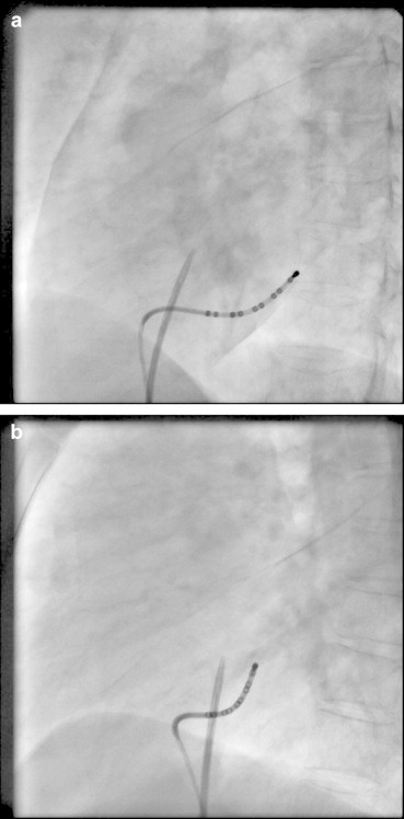 Fig. 13