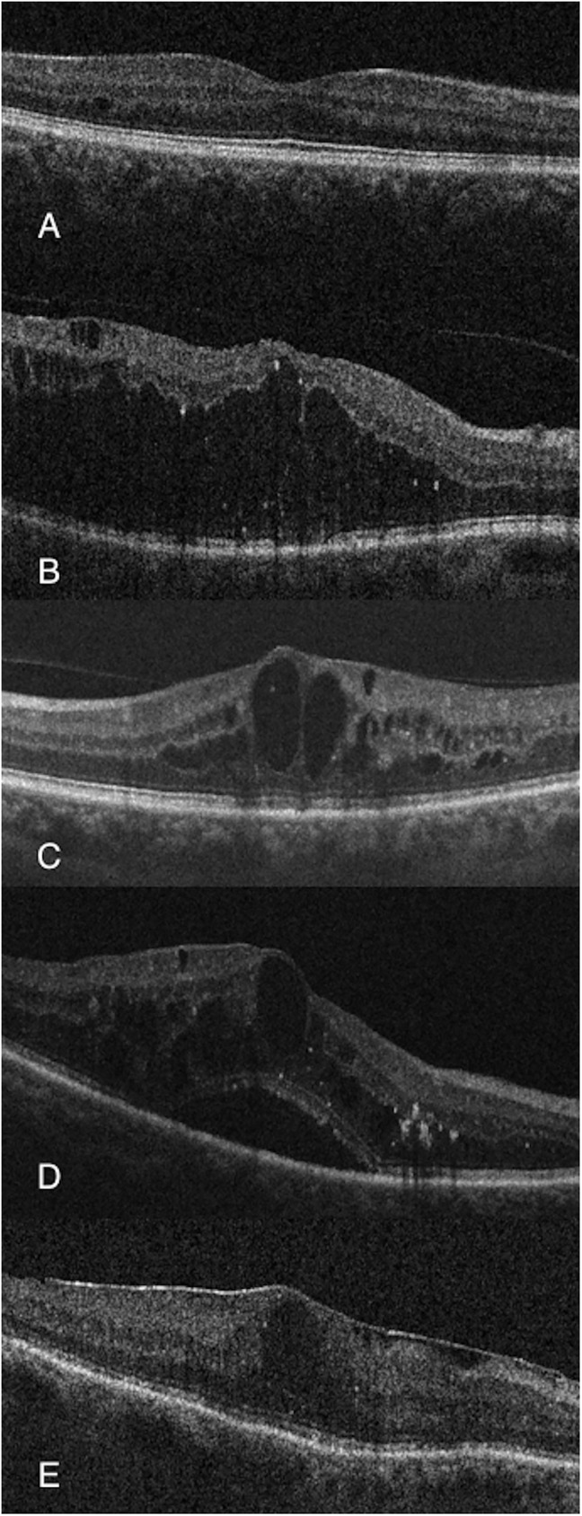 Fig 1