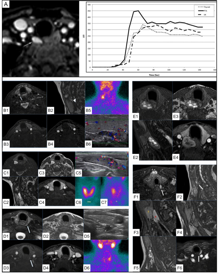 Figure 10