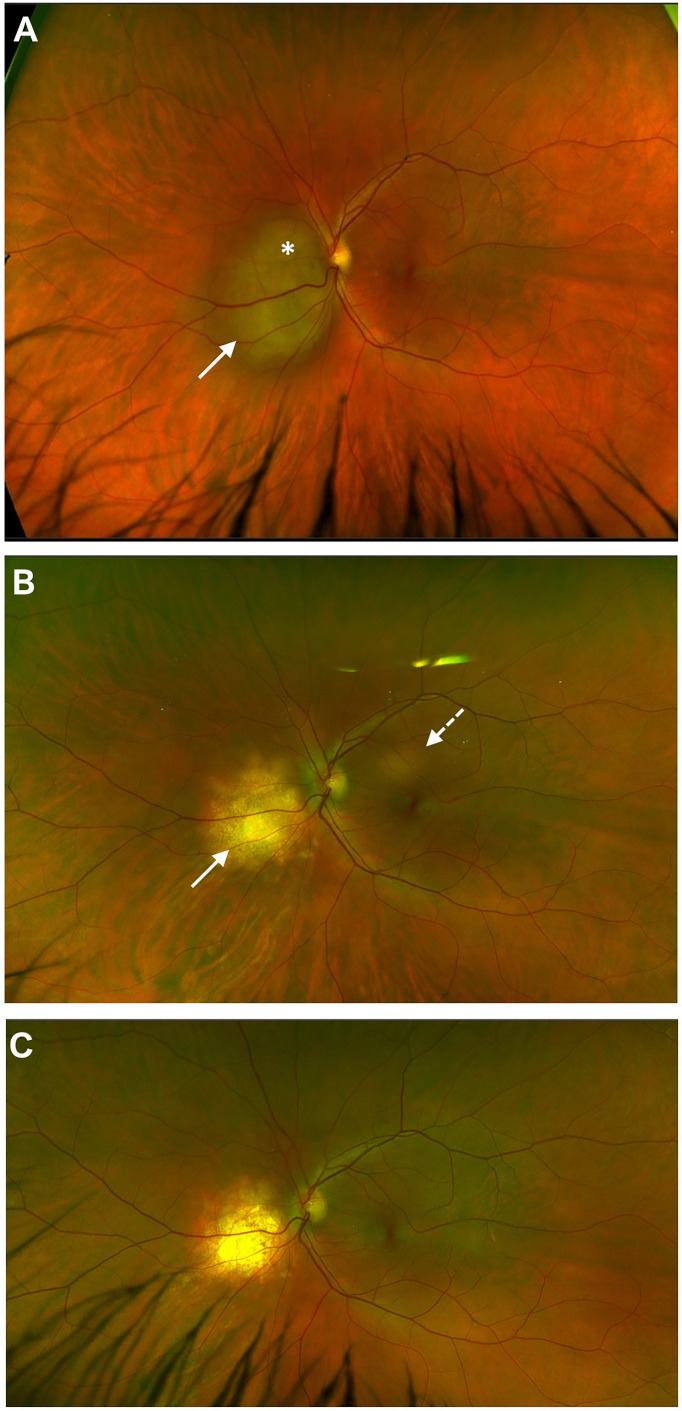 Figure 1