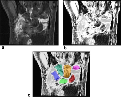 Figure 2