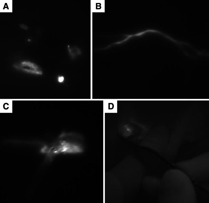 FIG. 1