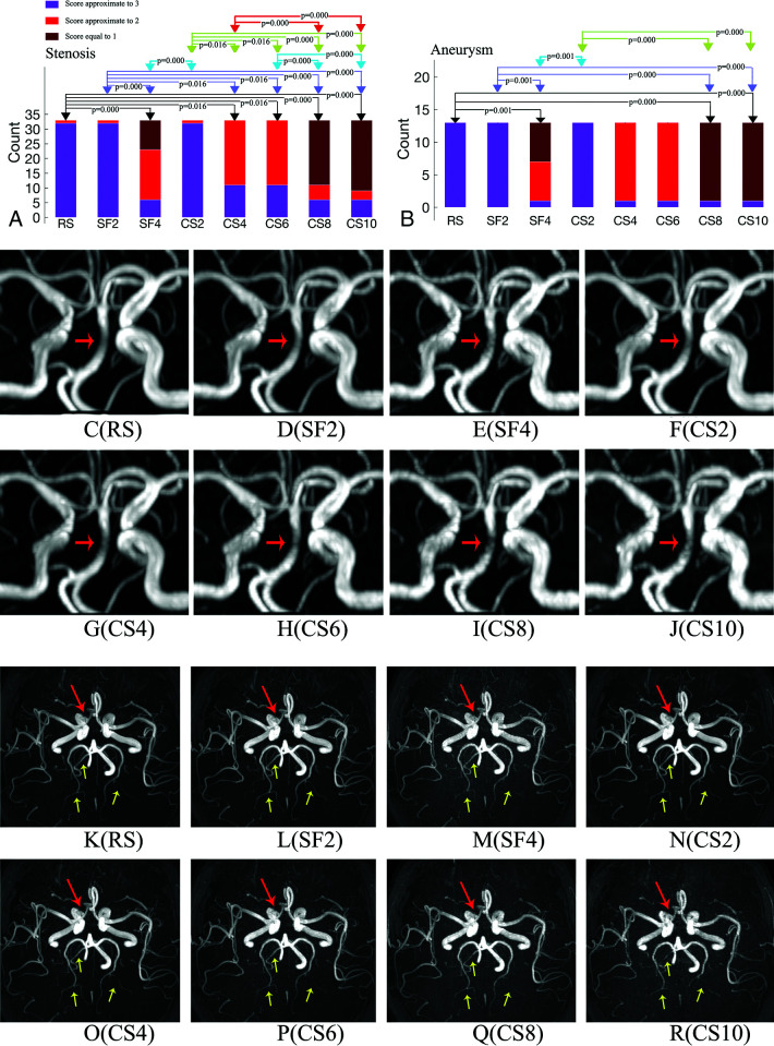 FIG 4.