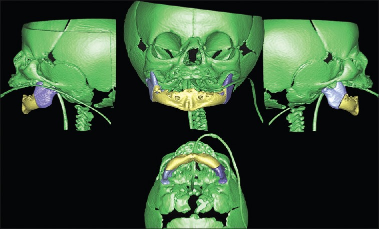 Figure 4