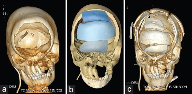 Figure 13