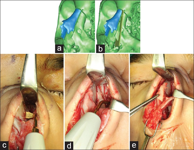 Figure 11