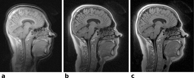 Fig 5