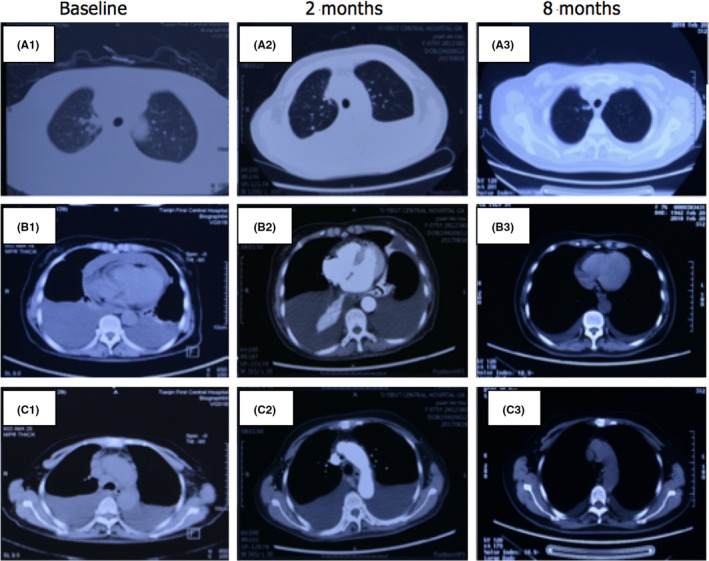 FIGURE 2