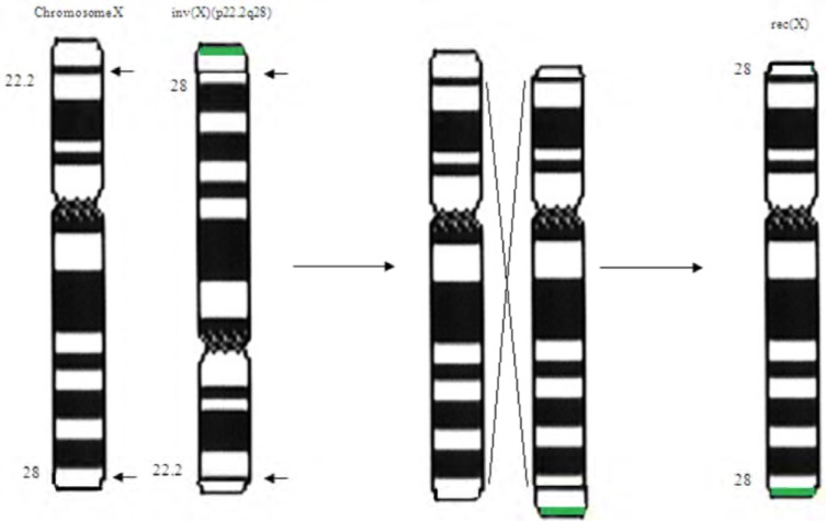 Fig. (1)