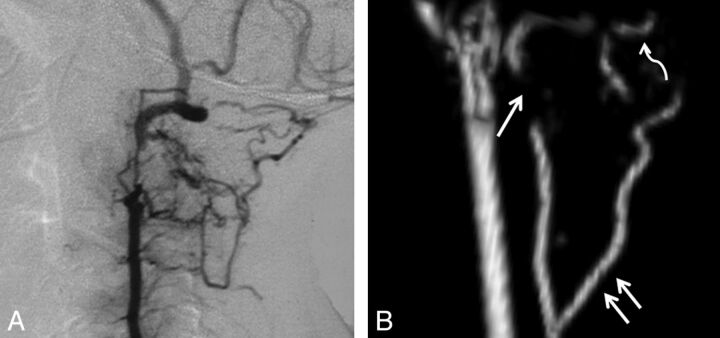 Fig 5.