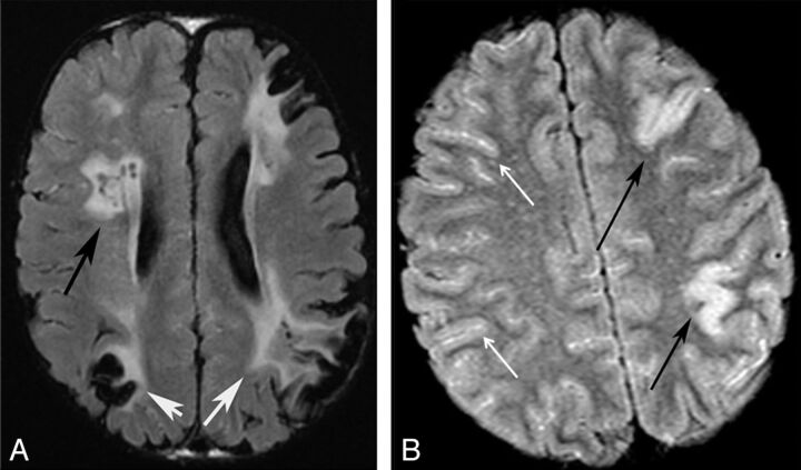 Fig 3.