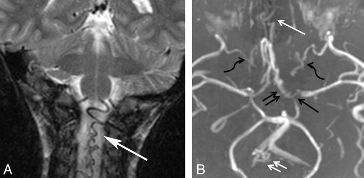 Fig 6.