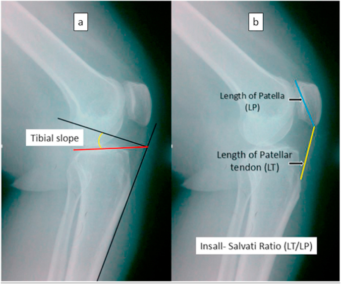 Fig. 1